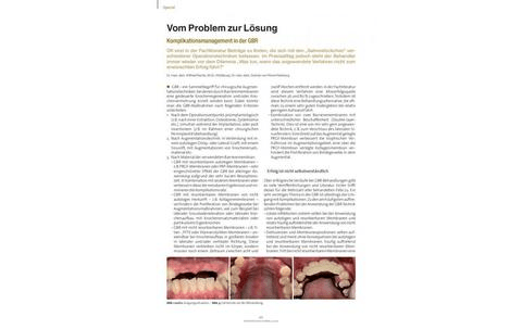 Vom Problem zur Lösung - Komplikationsmanagement in der GBR