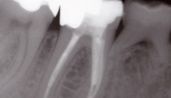 Moderne Endodontie - Ein Überblick