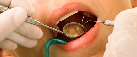 Experten für ganzheitliche ZahnMedizin zeigen den Zusammenhang von Entzündungsreaktionen und Dentalmaterial