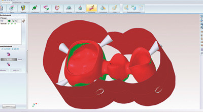Auf schnellstem Weg zum Zahnersatz
