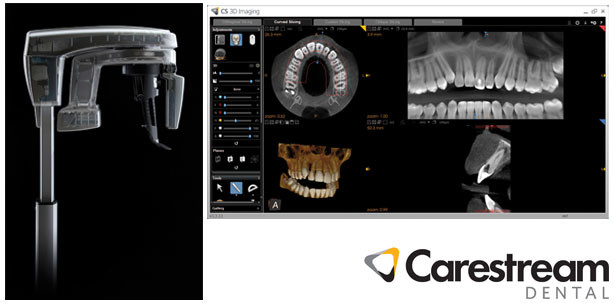 Imaging-Spezialist sorgt mit DVT-Neuheit für Aufsehen