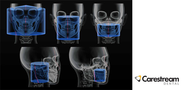 Studie bestätigt: CS 9300 von Carestream mit extrem niedriger Strahlenbelastung