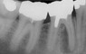 Quo vadis Endodontie?