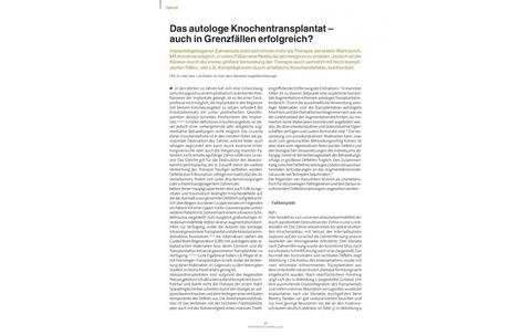 Das autologe Knochentransplantat – auch in Grenzfällen erfolgreich?