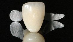 Socket Seal & TissueCare