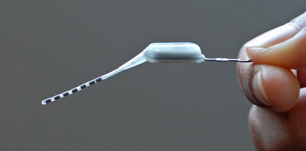 Mini-Stimulator im Oberkiefer schaltet Kopfschmerzen ab