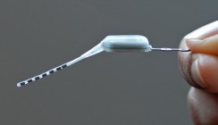 Mini-Stimulator im Oberkiefer schaltet Kopfschmerzen ab