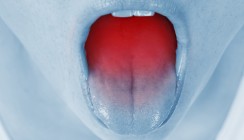 Sofortmaßnahmen bei Allergieschock durch Chlorhexidin
