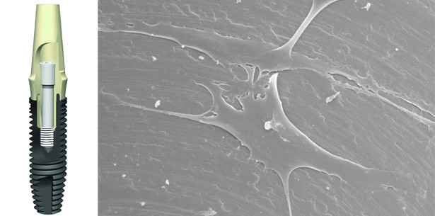 Studie zu Oberflächen von dentalen Implantaten