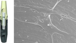 Studie zu Oberflächen von dentalen Implantaten