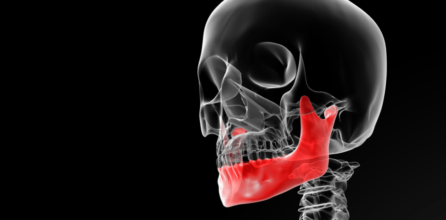 CMD-Screening erkennt Untersuchungsbedarf