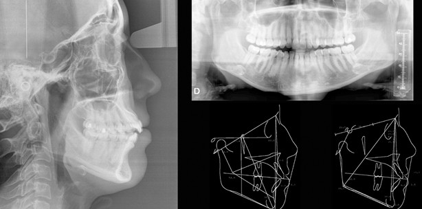 Schmerzbehandlung bei CMD