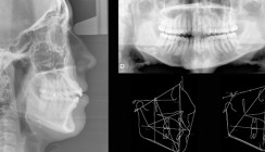 Schmerzbehandlung bei CMD