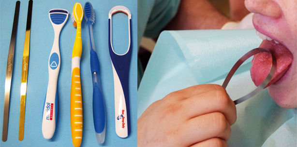 Halitosis und die Rolle der Zungenreinigung