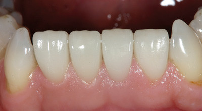 Rote Ästhetik für den ästhetischen Gesamteindruck