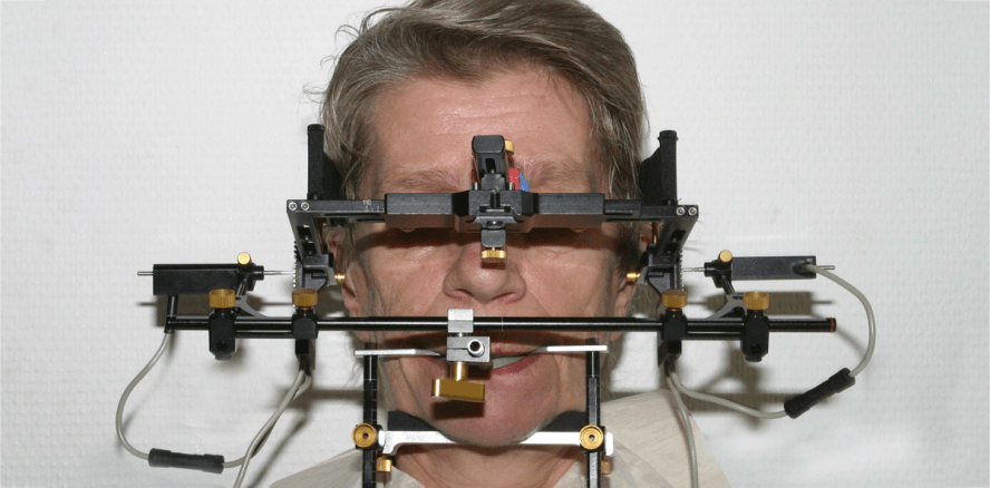 Ursachen und Diagnostik craniomandibulärer Dysfunktionen