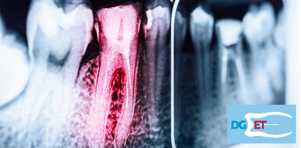 Noch freie Plätze beim Curriculum Endodontie der DGET