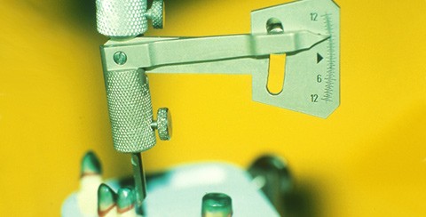 Konometrie: Rationelle Fertigung von Konuskronen