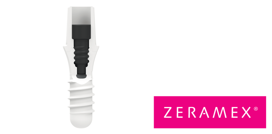 Dentalpoint senkt Preise für ZERAMEX® Keramikimplantate