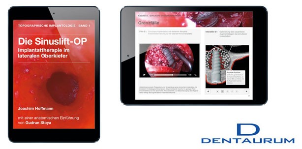 Jetzt auch in der Mac-Version: Multimediales iBook für Implantologen