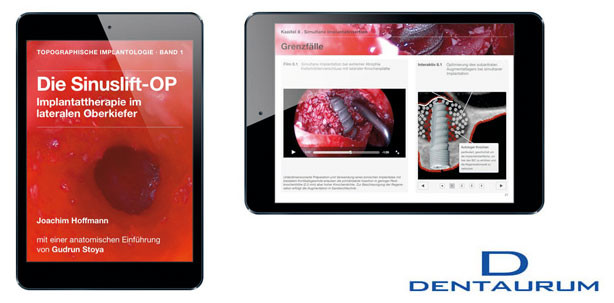 Jetzt auch in der Mac-Version: Multimediales iBook für Implantologen