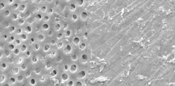 Eine Revolution in der Prophylaxe?