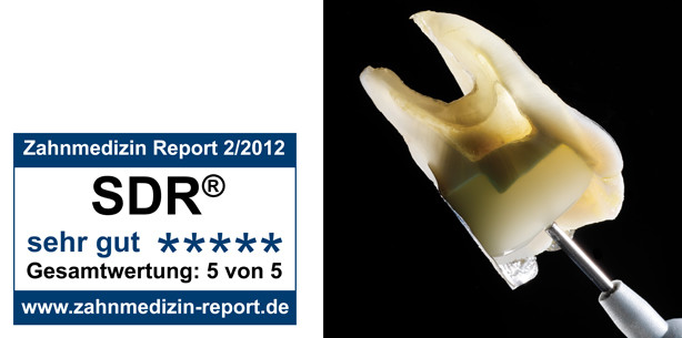 Anwender bestätigen: SDR vereinfacht die Füllungstherapie von Seitenzähnen