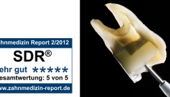 Anwender bestätigen: SDR vereinfacht die Füllungstherapie von Seitenzähnen
