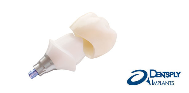 DENTSPLY Implants komplettiert Abutment-Angebot