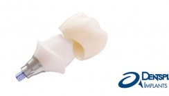 DENTSPLY Implants komplettiert Abutment-Angebot