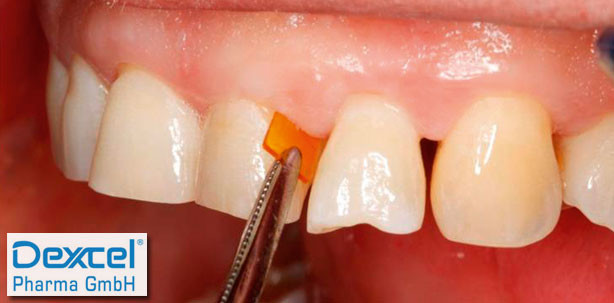 Team PerioChip auf der WID in Wien