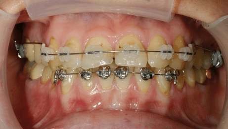 Interdisziplinäre Therapien für optimale Behandlungsergebnisse