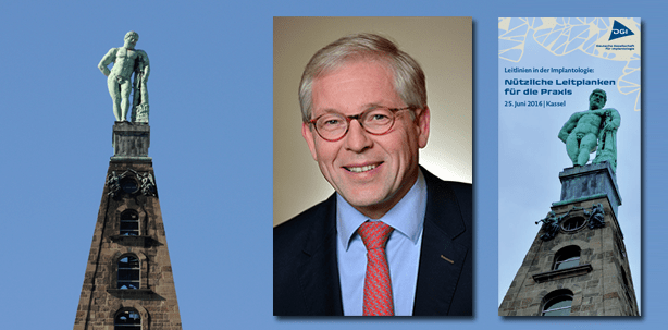 In der Implantologie sicher unterwegs: Leitlinien im Fokus
