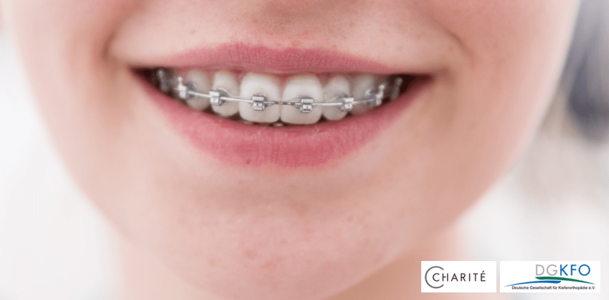 Charité-Wissenschaftler für Studie zu Brackets ausgezeichnet