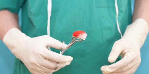 Neue Studie zu mikrochirurgischer Gewebetransplantation