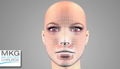 Gesichtschirurgen verwenden zunehmend digitale 3-D-Technik