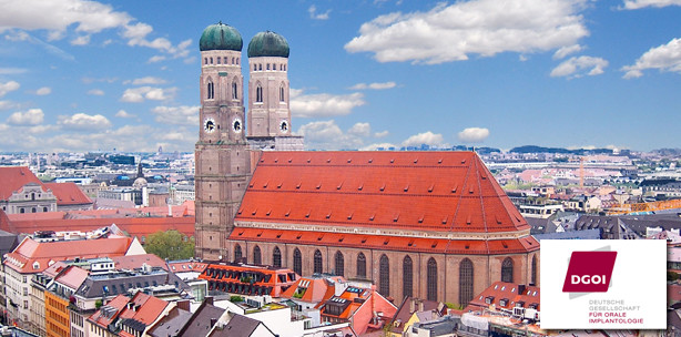 Implantologen und Zahntechniker im kollegialen Dialog