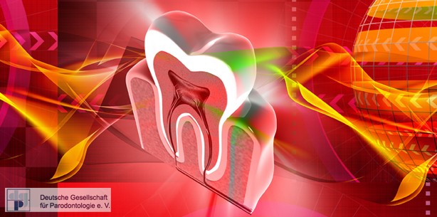 Interdisziplinäre Behandlungschancen bei Parodontitis und Diabetes