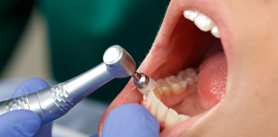 Dentalhygienikerinnen in der Schweiz gefragter denn je