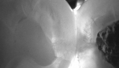 Webinar thematisiert röntgenfreie Kariesdiagnostik