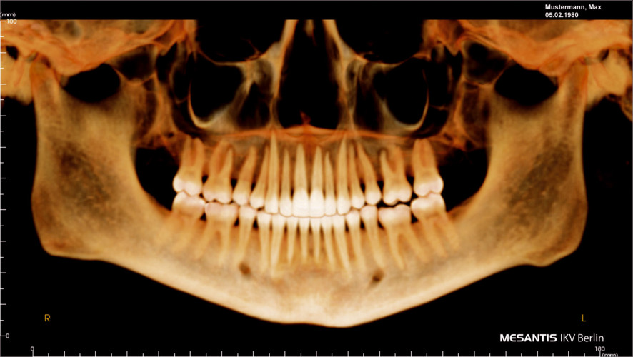 DVT - Datenschutz und Langzeitarchivierung