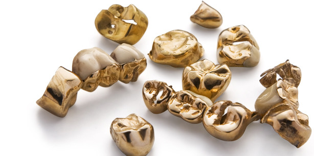 Zahngold-Diebstahl im Krematorium