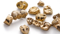 Zahngold-Diebstahl im Krematorium