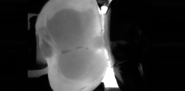 Umfangreiche Diagnostikmethoden im Überblick