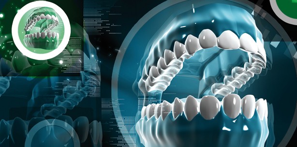 Digitale Abformung im Scan-Verfahren