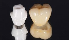 Computergestützt Implantieren: Digitaler Workflow erhöht Sicherheit