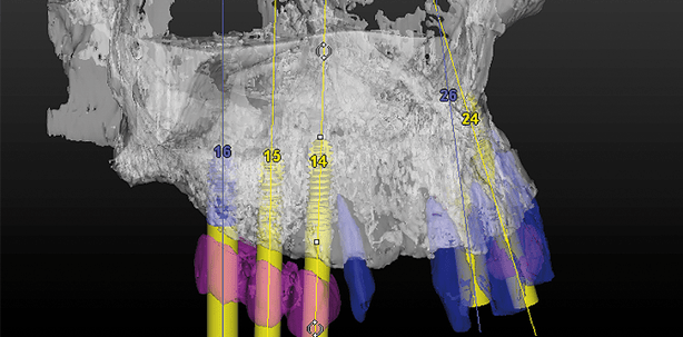 Workflow digitale in reale Welt – ein Fallbericht
