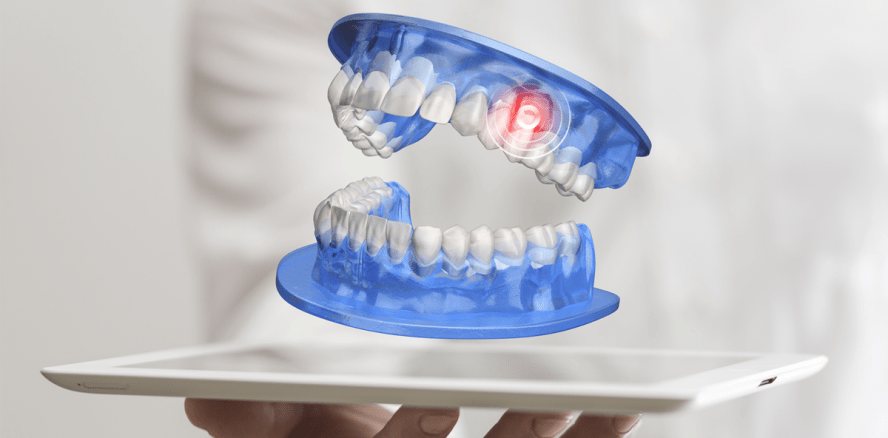 Digitale Behandlungsplanung im Überblick