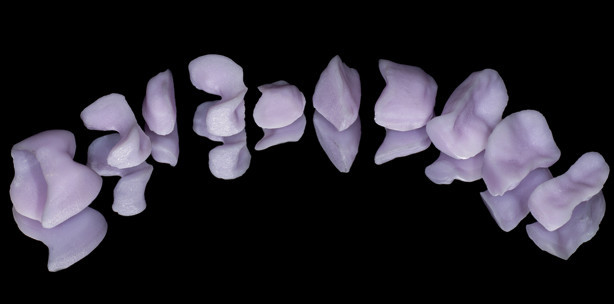 Zehn auf einen Streich