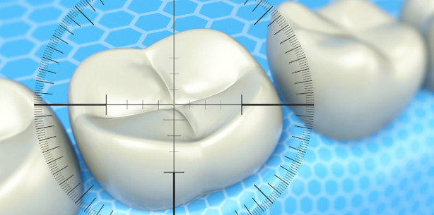 Digitale Zahnheilkunde im Kommen